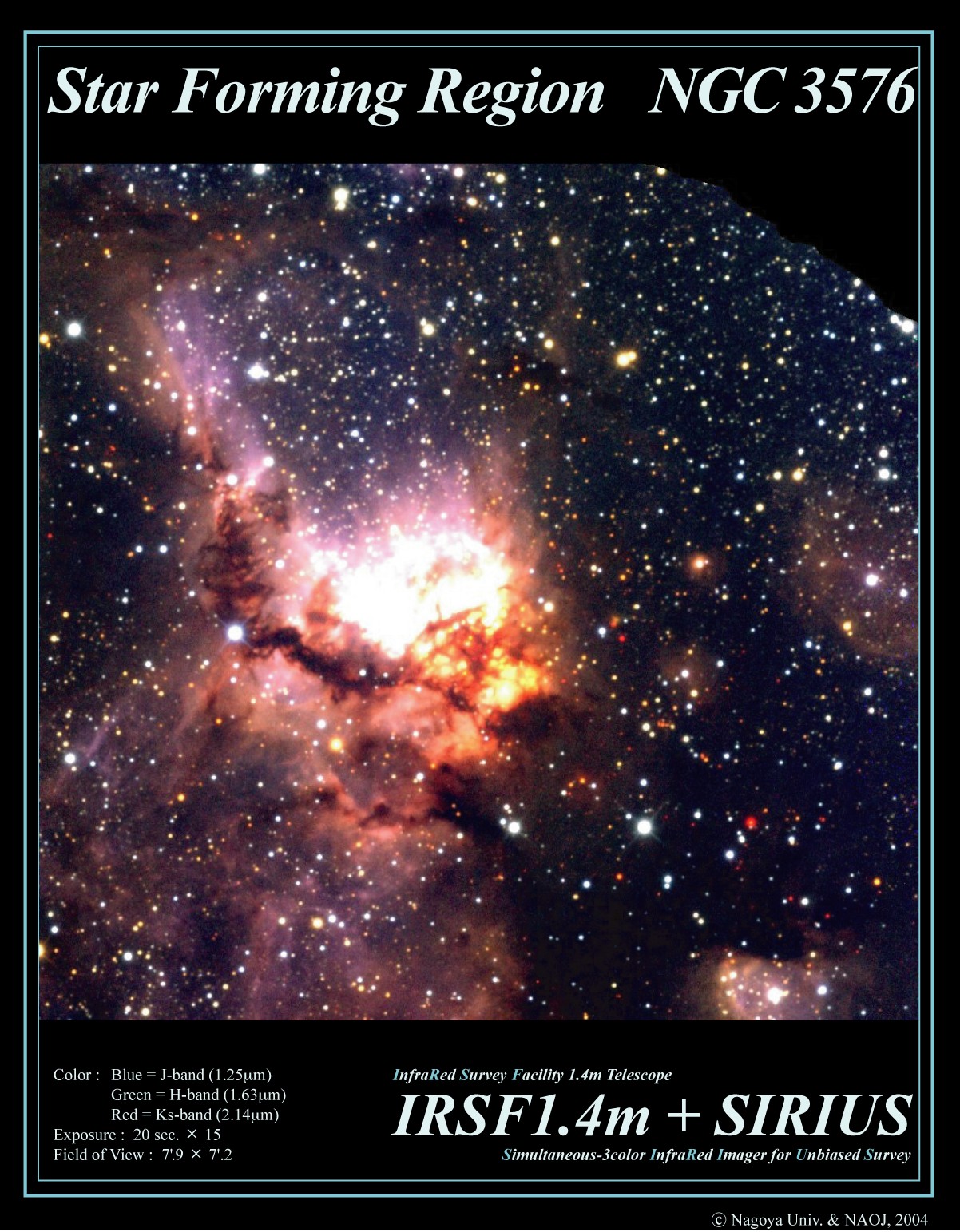 Star Forming Region : NGC 3576